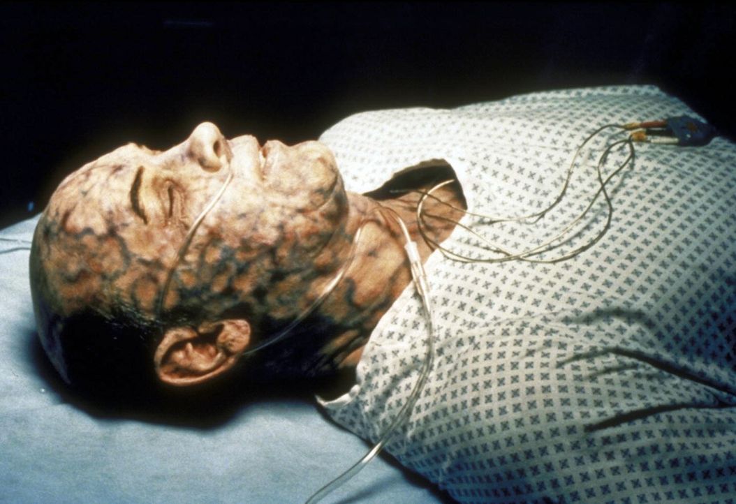 Aufgrund politischer Hintergründe ist Skinner (Mitch Pileggi) mit einem High-Tech-Gift infiziert worden ... - Bildquelle: TM +   2000 Twentieth Century Fox Film Corporation. All Rights Reserved.